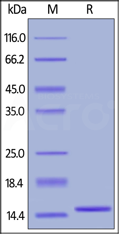 Human IL-2, Tag Free (Cat. No. IL2-H4113) SDS-PAGE gel