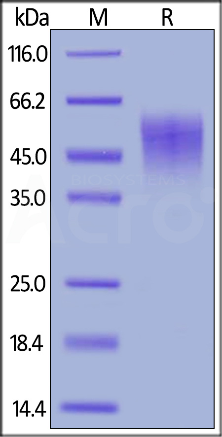 Mouse IL-2 R alpha, His Tag (Cat. No. ILA-M52H9) SDS-PAGE gel