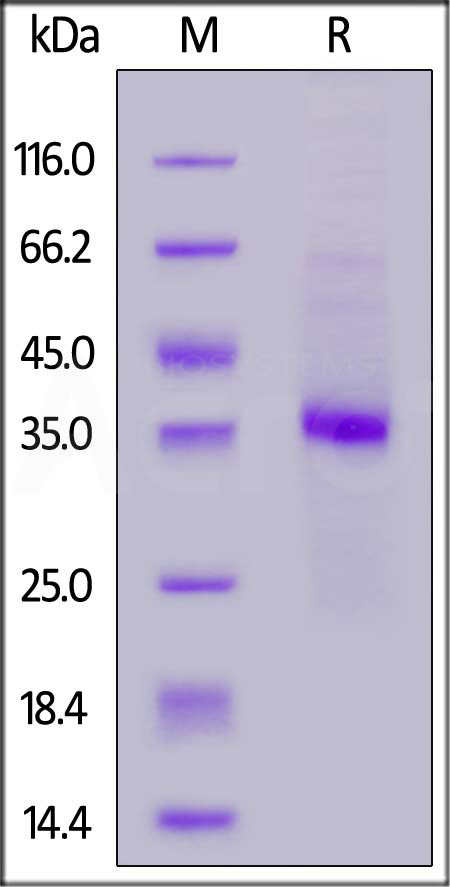 Canine IL-2 R beta, His Tag (Cat. No. ILA-C52H5) SDS-PAGE gel