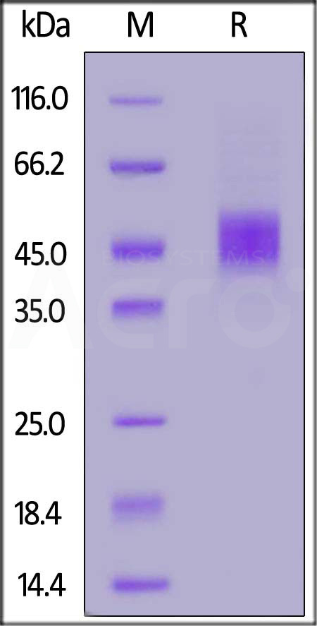 Mouse IL-2 R beta, His Tag (Cat. No. ILA-M52H5) SDS-PAGE gel
