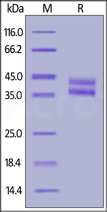 Biotinylated Human IL-2 R beta, His,Avitag (Cat. No. ILB-H82E3) SDS-PAGE gel