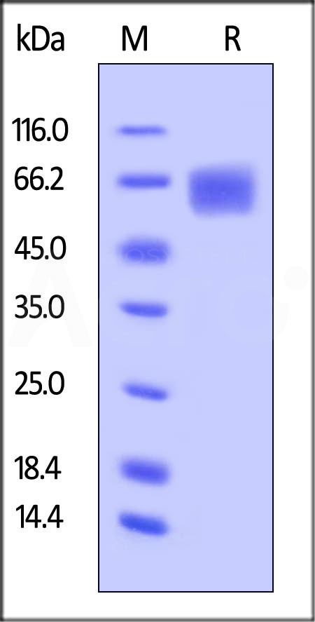 Human IL-6 R alpha, His Tag (Cat. No. ILR-H4223) SDS-PAGE gel