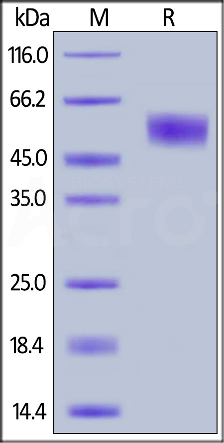 Human IL-1 RII, His Tag (Cat. No. IL2-H4226) SDS-PAGE gel