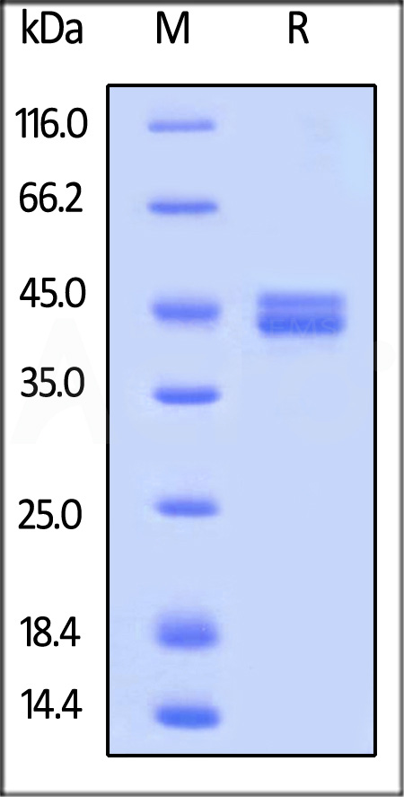 Human IL-12B, His Tag (Cat. No. NK2-H52H7) SDS-PAGE gel