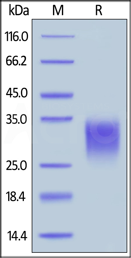 Human IL-22, His Tag (Cat. No. IL2-H524a) SDS-PAGE gel