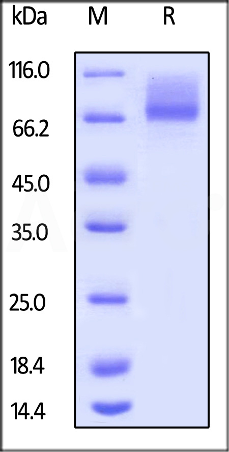Human IL-7 R alpha, Mouse IgG2a Fc Tag (Cat. No. IL7-H5258) SDS-PAGE gel