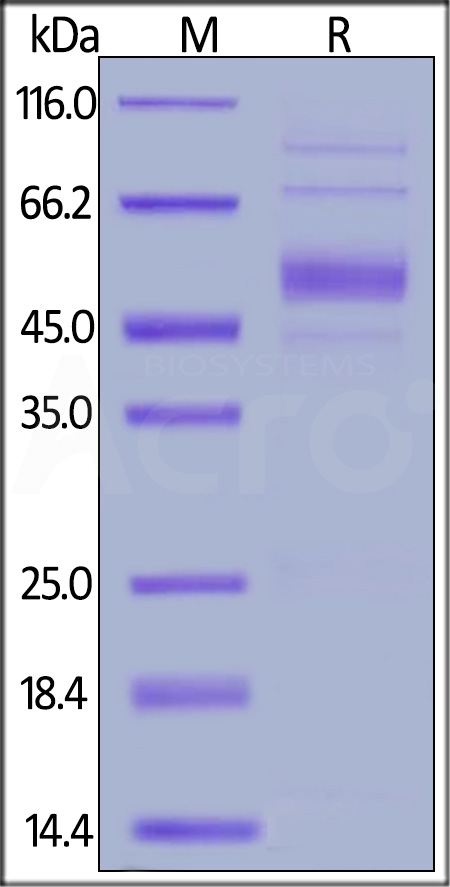 Human IL-5 R alpha, His Tag (Cat. No. ILA-H52H4) SDS-PAGE gel
