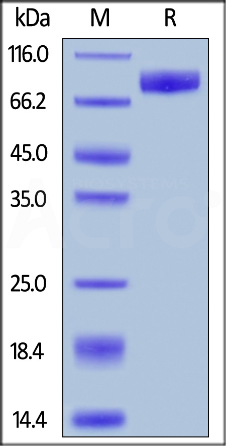 Human IL-1 Rrp2, Fc Tag (Cat. No. IL2-H5254) SDS-PAGE gel