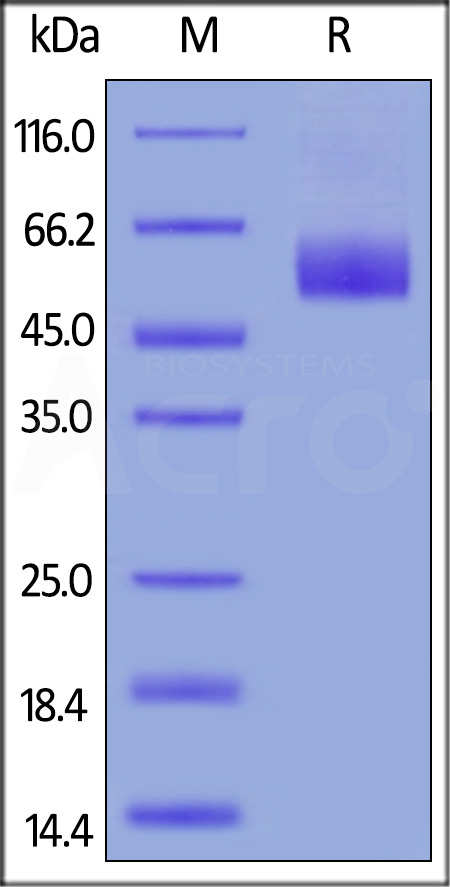Human IL-1 Rrp2, His Tag (Cat. No. IL2-H52H6) SDS-PAGE gel