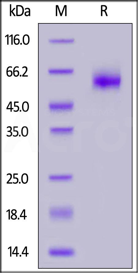 Human IL-1 Rrp2 (C154S, C262S), His Tag (Cat. No. IL2-H52H4) SDS-PAGE gel