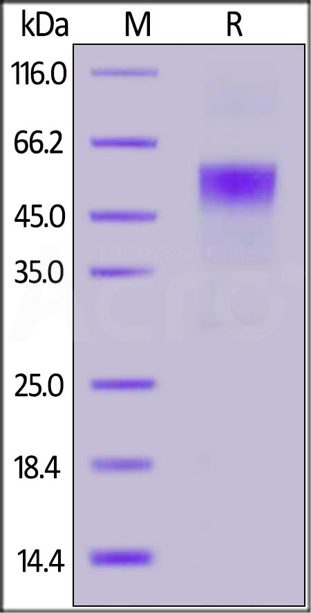 Cynomolgus IL-3 R alpha, His Tag (SPR verified) (Cat. No. ILA-C52H6) SDS-PAGE gel