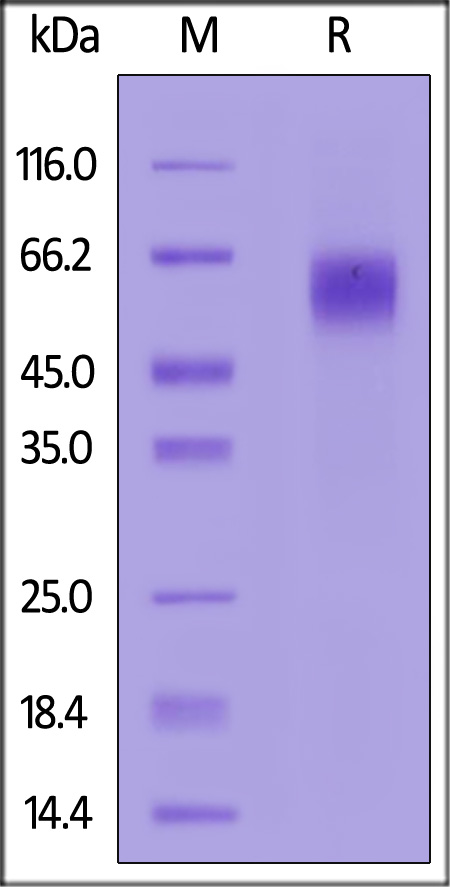 Biotinylated Human  IL-1 Rrp2, His,Avitag (Cat. No. IL2-H82E9) SDS-PAGE gel