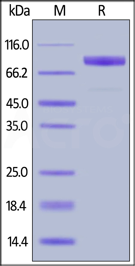 Human IL-1RL1, Fc Tag (Cat. No. IL1-H5250) SDS-PAGE gel