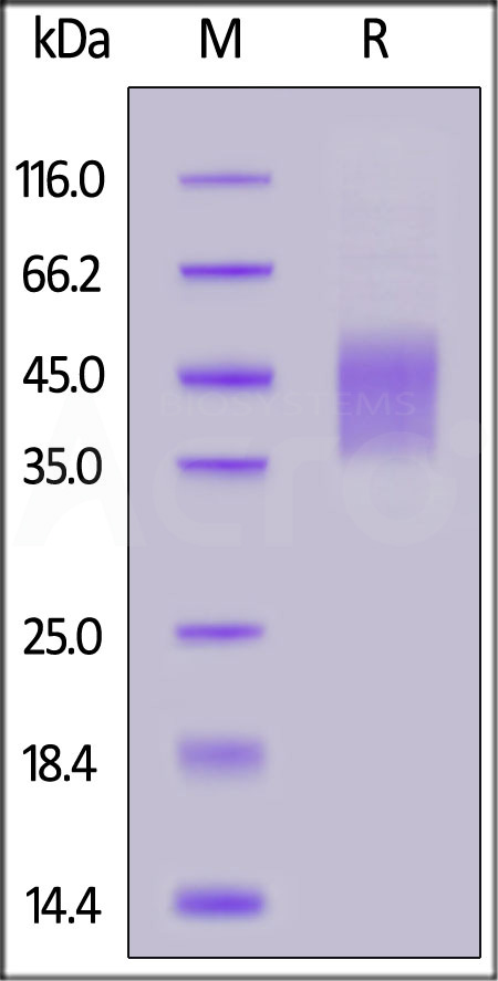 Biotinylated Human IL-4 R alpha, Avitag,His Tag (Cat. No. ILR-H82E9) SDS-PAGE gel