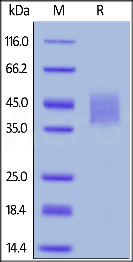 Human IL-4 R alpha, His Tag (Cat. No. ILR-H5221) SDS-PAGE gel