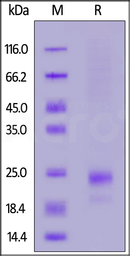 Mouse IL-10, His Tag (Cat. No. IL0-M4248) SDS-PAGE gel