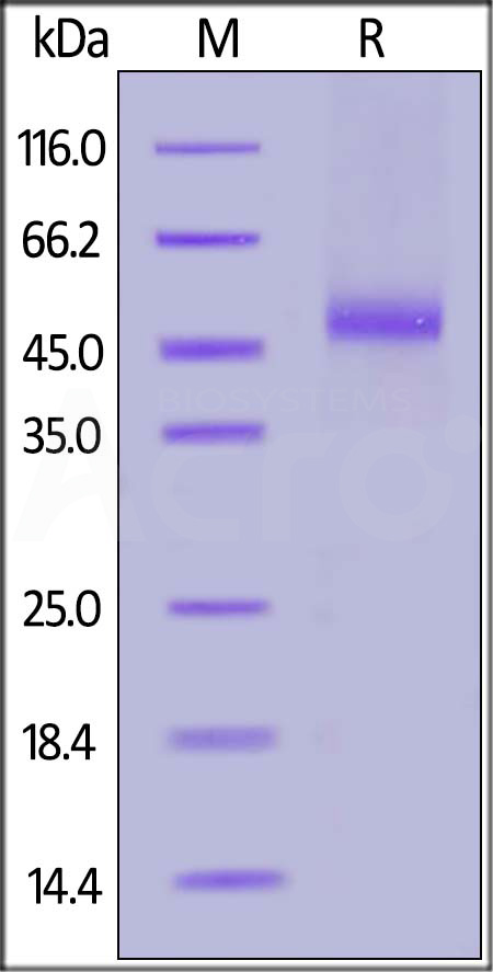 FITC-Labeled Human IL-13 R alpha 2, His Tag (Cat. No. IL2-HF2H3) SDS-PAGE gel