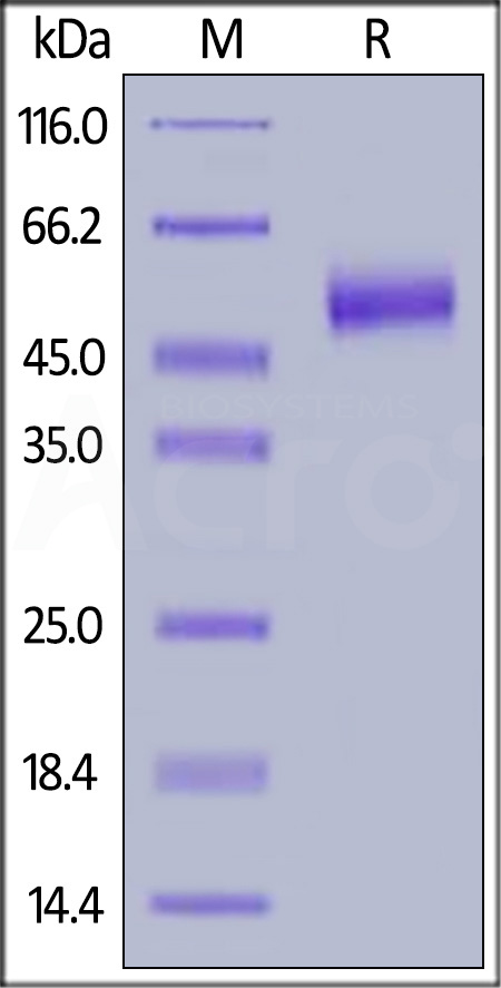Human IL-13 R alpha 2, His Tag (Cat. No. IL2-H52H5) SDS-PAGE gel