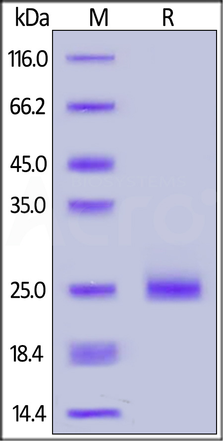 Human IL-17C, His Tag (Cat. No. ILC-H52H7) SDS-PAGE gel
