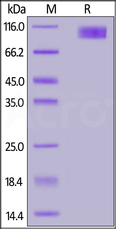 Human IL-17 RC, Fc Tag (Cat. No. ILC-H5259) SDS-PAGE gel