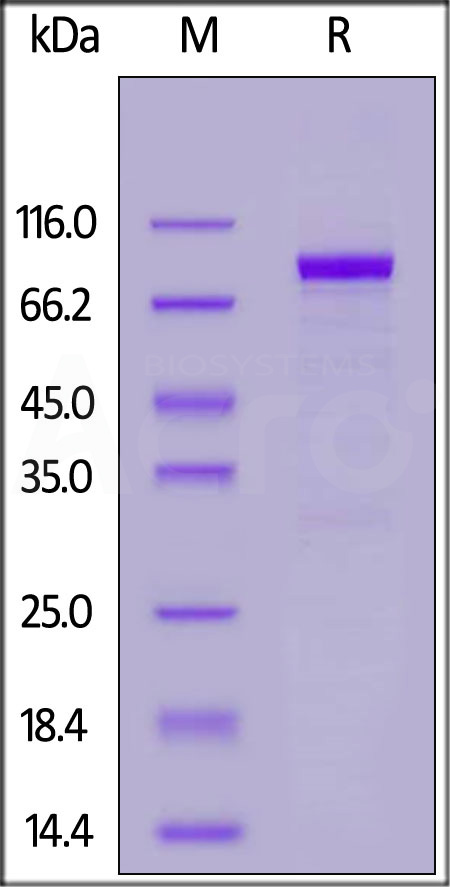 Human IL-18 R1, Fc Tag (Cat. No. IL1-H5259) SDS-PAGE gel