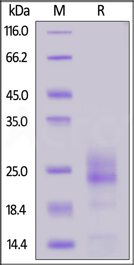 Mouse IL-5, His Tag (Cat. No. IL5-M52H3) SDS-PAGE gel
