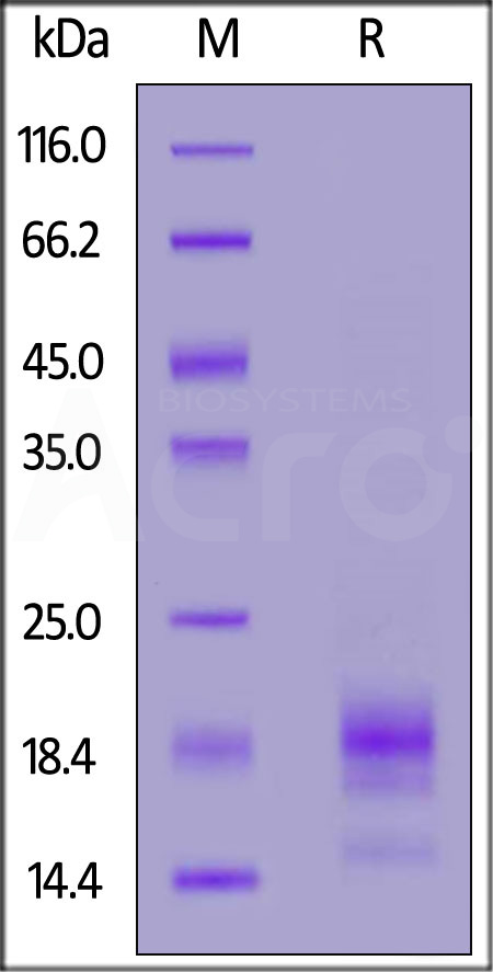 Rabbit IL-5, His Tag (Cat. No. IL5-R52H4) SDS-PAGE gel