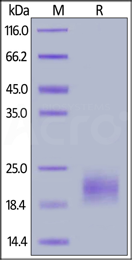 Human IL-5, His Tag (Cat. No. IL5-H52H3) SDS-PAGE gel