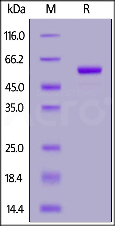 Human IL-7, Fc Tag (Cat. No. IL7-H5253) SDS-PAGE gel