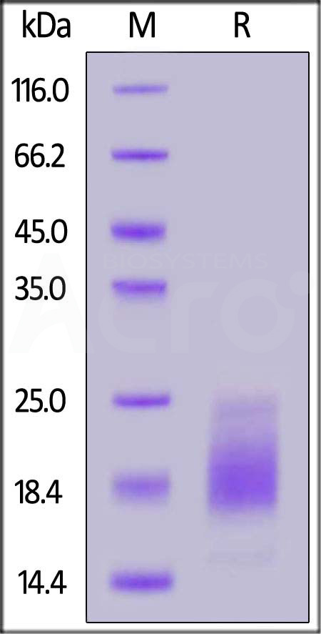 Human IL-15, His Tag (Cat. No. IL5-H52H8) SDS-PAGE gel