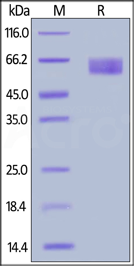 Human IL-18BP, Fc Tag (Cat. No. ILP-H5253) SDS-PAGE gel