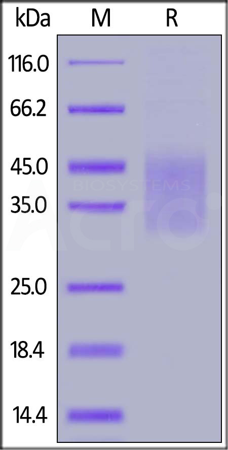Human IL-18BP, His Tag (Cat. No. ILP-H5222) SDS-PAGE gel