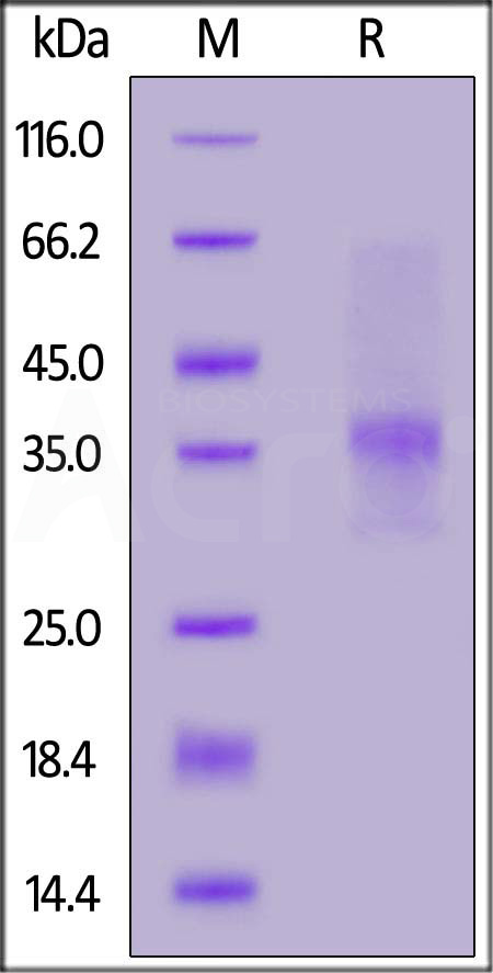 Human IL-34, His Tag (Cat. No. IL4-H52H3) SDS-PAGE gel