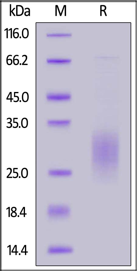 Human IL-3, His Tag (Cat. No. IL3-H52H9) SDS-PAGE gel