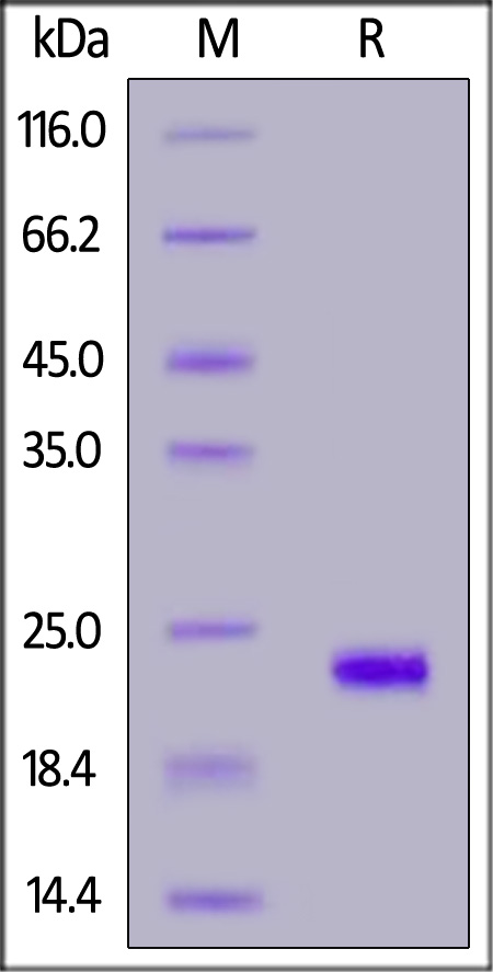 Human IL-37, His Tag (Cat. No. ILB-H51H5) SDS-PAGE gel