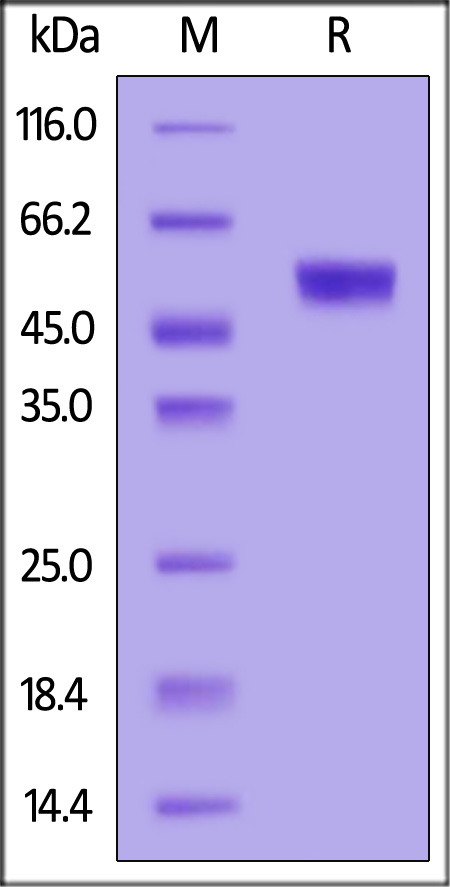 Human IL-11 R alpha, His Tag (Cat. No. ILR-H52H5) SDS-PAGE gel