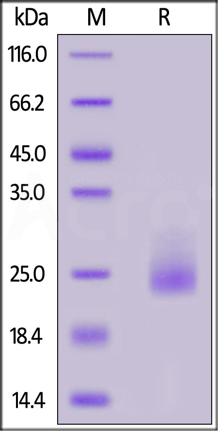 Human IL-31, His Tag (Cat. No. IL1-H5247) SDS-PAGE gel