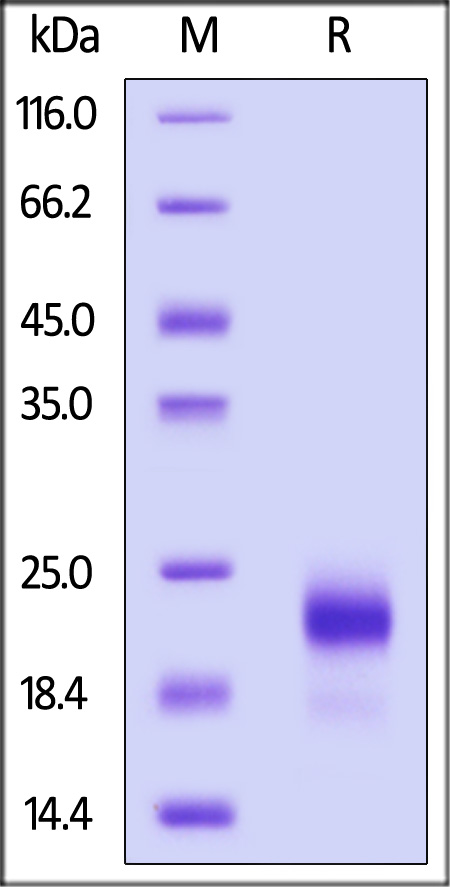 Human  IL-4, His Tag (Cat. No. IL4-H52H9) SDS-PAGE gel