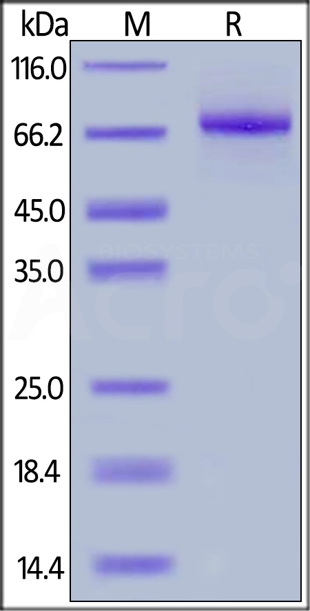 Human IL-12 R beta 1, His Tag (Cat. No. ILB-H52H9) SDS-PAGE gel