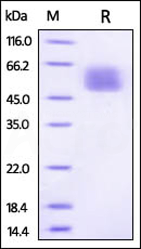 Mouse IL-13 R alpha 1, His Tag (Cat. No. IL1-M52H7) SDS-PAGE gel