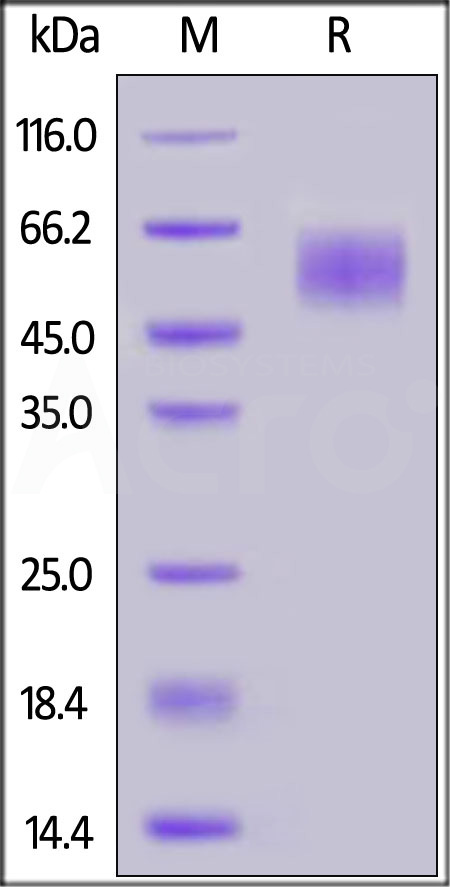 Human IL-13 R alpha 1, His Tag (SPR verified) (Cat. No. IL1-H5224) SDS-PAGE gel