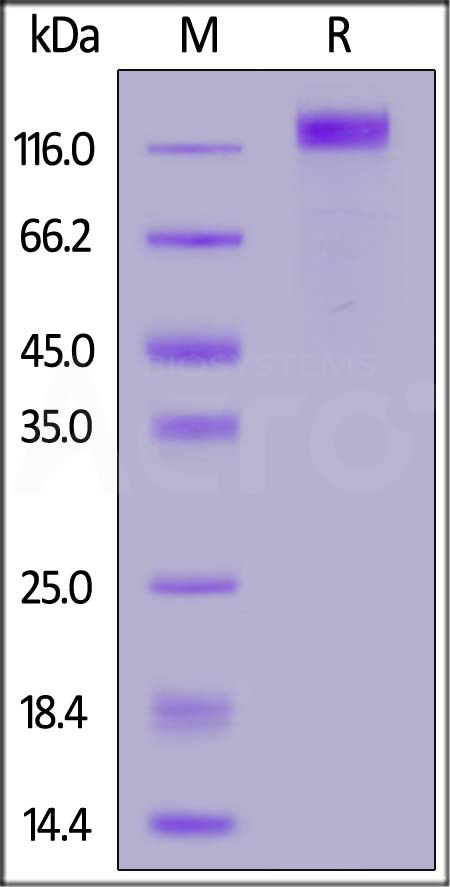 Rhesus macaque VEGF R2, His Tag (Cat. No. VE2-C52H3) SDS-PAGE gel