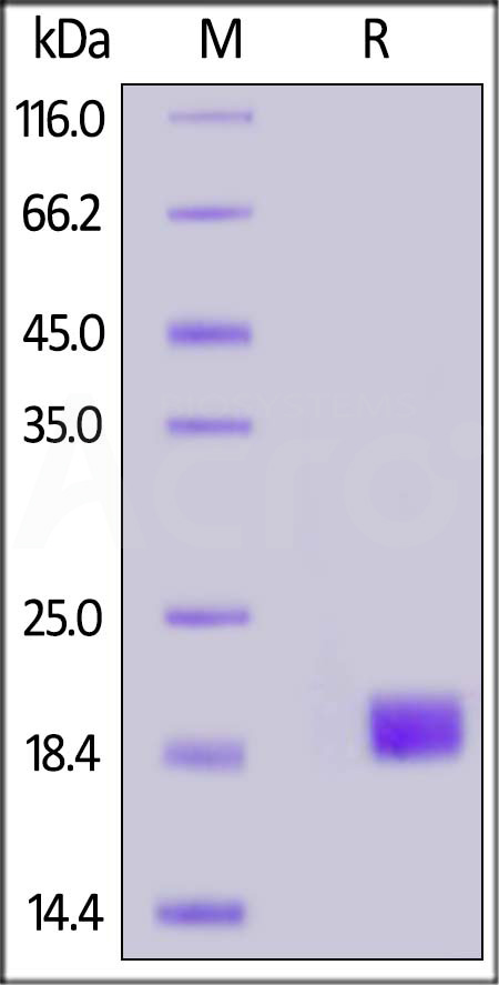 Human VEGF-D, His Tag (Cat. No. VED-H5228) SDS-PAGE gel