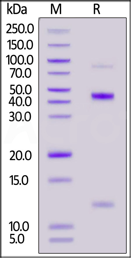 Human Latent TGFB2, His Tag (Cat. No. TG2-H5243) SDS-PAGE gel