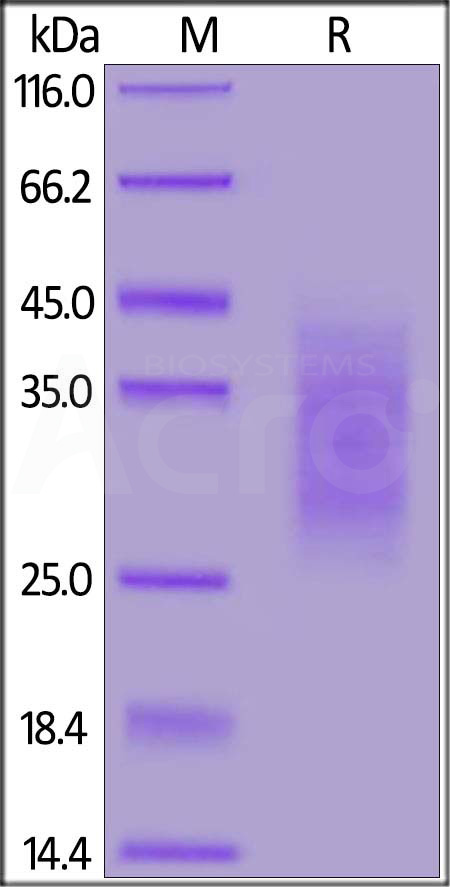 Biotinylated Human TGF-beta RII, His,Avitag (Cat. No. TG2-H82E4) SDS-PAGE gel