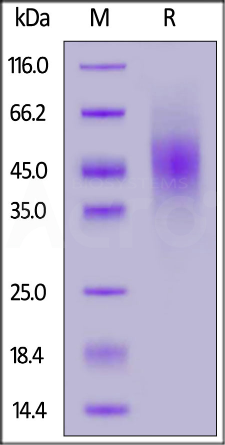 Human FGFR2 (IIIb), His Tag (Cat. No. FGB-H5223) SDS-PAGE gel