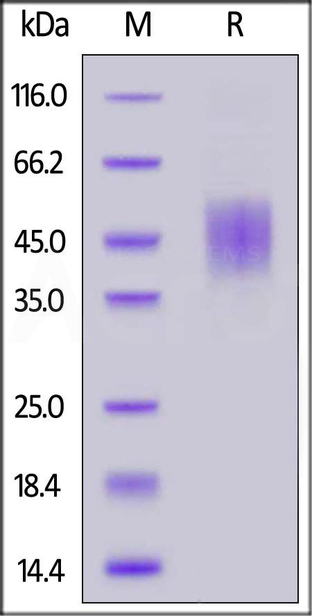 Human FGFR2 (IIIc), His Tag (Cat. No. FGC-H5225) SDS-PAGE gel