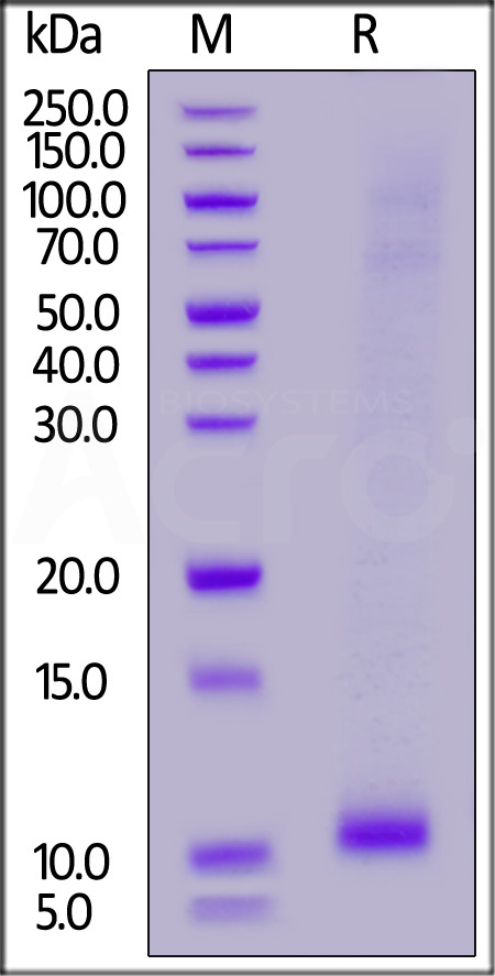 Human EGF, His Tag (Cat. No. EGF-H52H3) SDS-PAGE gel