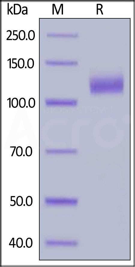 Human EGF R, Fc Tag (Cat. No. EGR-H5252) SDS-PAGE gel