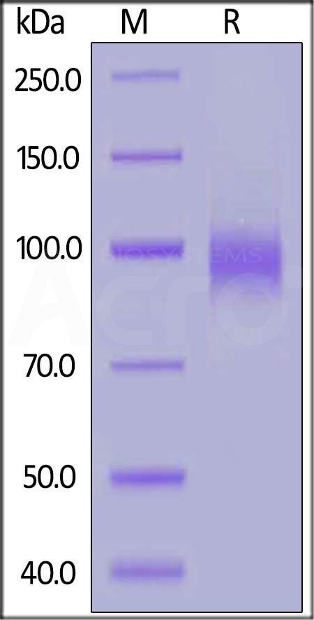 Human EGF R, His Tag (Cat. No. EGR-H5222) SDS-PAGE gel